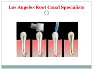 Los Angeles Root Canal Specialists
