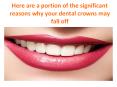 Here are a portion of the significant reasons why your crowns may fall off PowerPoint PPT Presentation