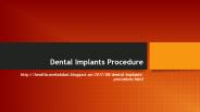 Dental Implants Procedure