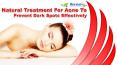 Natural Treatment For Acne To Prevent Dark Spots Effectively PowerPoint PPT Presentation