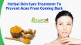 Herbal Skin Care Treatment To Prevent Acne From Coming Back