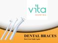 Complete Guide of Dental Braces PowerPoint PPT Presentation