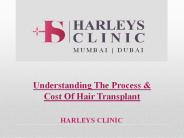 Understanding The Process & Cost Of Hair Transplant