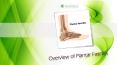 Overview of Plantar Fasciitis PowerPoint PPT Presentation