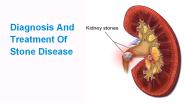 Diagnosis And Treatment Of Stone Disease