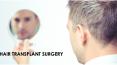 Hair Transplant PowerPoint PPT Presentation