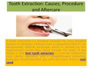 Tooth Extraction: Causes, Procedure and Aftercare
