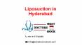 Liposuction in Hyderabad | Liposuction Cost in Hyderabad PowerPoint PPT Presentation