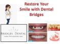 Female Dentist Brandon- Restore Your Smile With Dental Bridges | Bridges Dental PowerPoint PPT Presentation