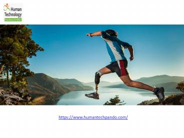 Artificial Limb Prosthesis