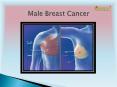 Male Breast Cancer: A rising concern among men PowerPoint PPT Presentation
