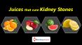 Stay Healthy!- Reduce kidney stones with these Juices - BookMyScans PowerPoint PPT Presentation