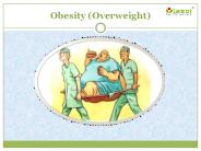 Obesity (Overweight): Symptoms, Causes and treatment