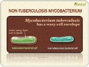 Crucial information on Non-tuberculosis Mycobacterium