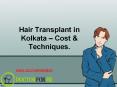 Hair Transplant Kolkata - Cost & Techniques