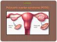 Polycystic ovarian syndrome (PCOS) : Causes, Symptoms, Diagnosis, Complication and Treatment PowerPoint PPT Presentation