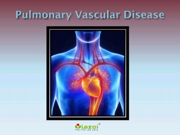 Pulmonary Vascular Disease: Symptoms, causes, diagnosis and treatment