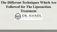 The Different Techniques Which Are Followed for The Liposuction Treatment PowerPoint PPT Presentation