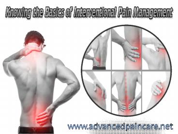 Knowing the Basics of Interventional Pain Management