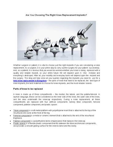 Are you choosing the right knee replacement implants?