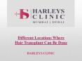 Different Locations Where Hair Transplant Can Be Done PowerPoint PPT Presentation