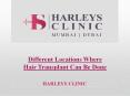 Different Locations Where Hair Transplant Can Be Done (1) PowerPoint PPT Presentation