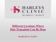 Different Locations Where Hair Transplant Can Be Done (1)