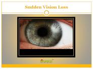 Sudden vision loss needs immediate medical attention