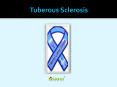 Tuberous Sclerosis: Overview of symptoms, causes and treatment PowerPoint PPT Presentation