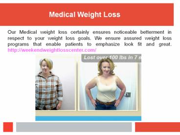 Cellulite Treatments (2)