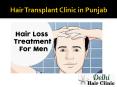 Cheap Hair Transplant Clinic in Punjab