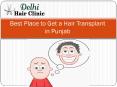 Cheap Hair Transplant Clinic in Punjab Cost