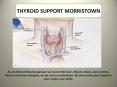 Thyroid Test Morristown PowerPoint PPT Presentation