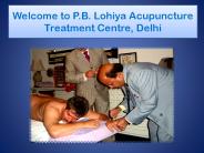 Acupuncture in Delhi