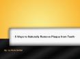 5 Ways to Naturally Remove Plaque from Teeth PowerPoint PPT Presentation