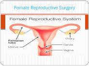 Female Reproductive Surgery 16 sep 17