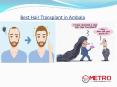 Best Hair Transplant In Ambala PowerPoint PPT Presentation