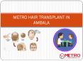 Metro Hair Transplant In Ambala PowerPoint PPT Presentation