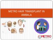 Metro Hair Transplant In Ambala