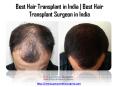 Best Hair Transplant in India & Best Hair Transplant Surgeon in India PowerPoint PPT Presentation