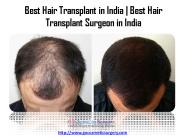 Best Hair Transplant in India & Best Hair Transplant Surgeon in India