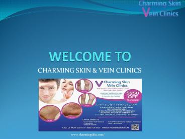 Where to find professional help for varicose veins?