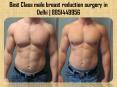 Get the best male chest reduction surgery cost in Delhi @8851449956 PowerPoint PPT Presentation