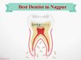 Best Dentist in Nagpur PowerPoint PPT Presentation