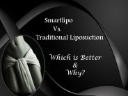 Smartlipo Vs. Traditional Liposuction: Which is Bettery & Why?