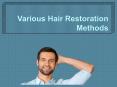 various hair Restoration Methods PowerPoint PPT Presentation