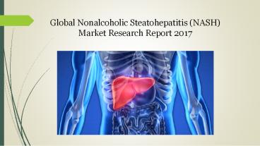 Global nonalcoholic steatohepatitis (nash) market research report 2017