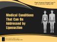 Medical Conditions That Can Be Addressed By Liposuction PowerPoint PPT Presentation