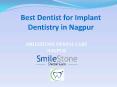 Best Dentist for Implant Dentistry in Nagpur PowerPoint PPT Presentation