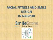 Facial Fitness and Smile Design in Nagpur (1)